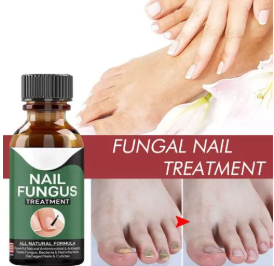 100 % working Fast Nail Fungal Treatments Nail Repair Essences Serum Care Treatments Foot Nail Fungus Removal Gel Paronychia Onychomycosis